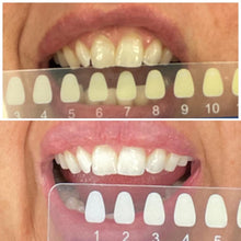 Load image into Gallery viewer, Beaut Teeth Whitening: Cozy Kit